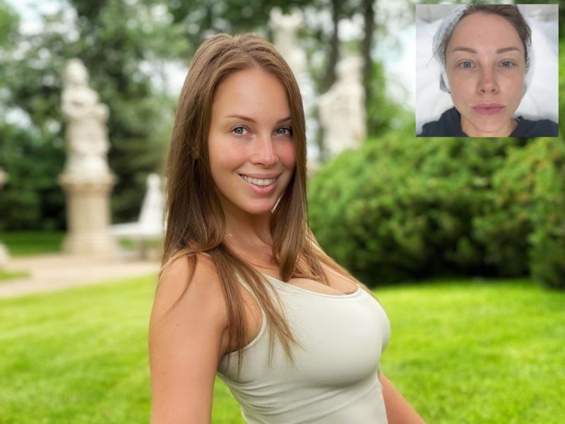 Полина Диброва увеличила губы