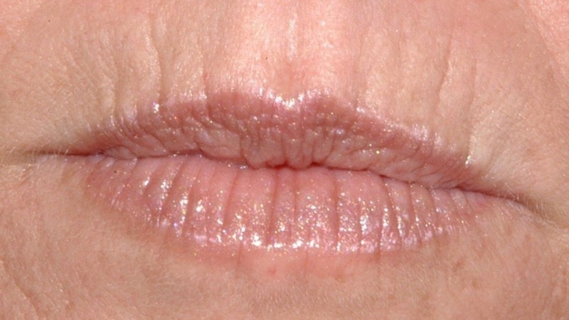 Маски от кисетных морщин: домашний уход