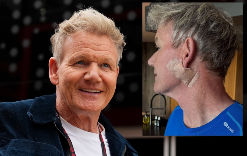 Гордон Рамзи рассказал, как заработал рак Гордон Рамзи рассказал, как заработал рак