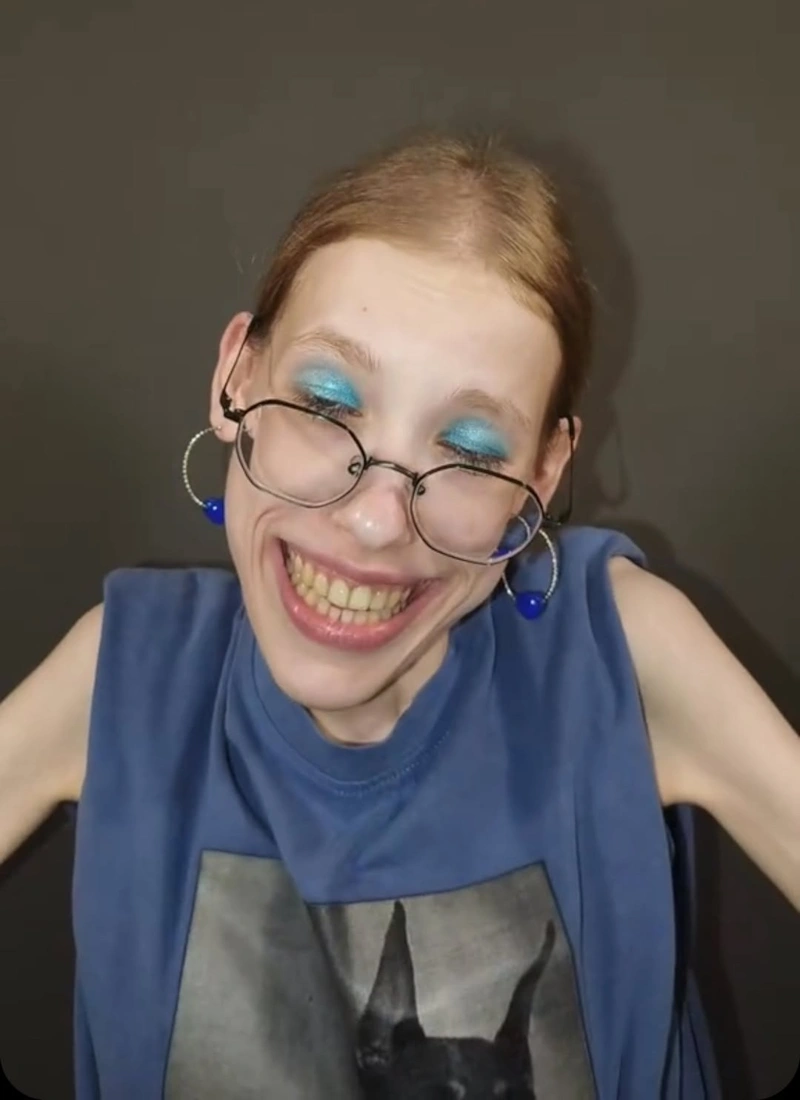 Рая SCP без брекетов Рая SCP без брекетов