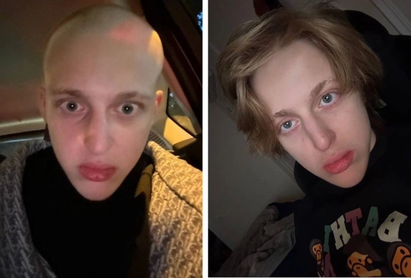 Baby Melo лысый и с волосaми