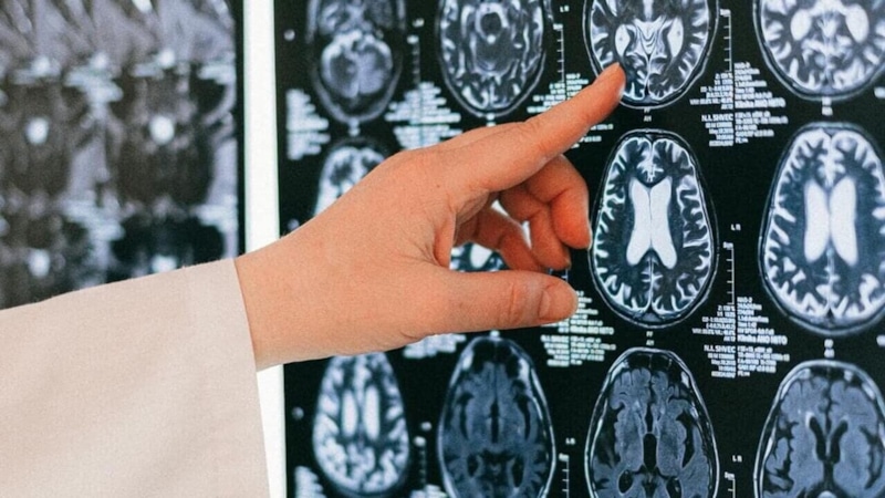 Инсульт наступает: на что обратить внимание