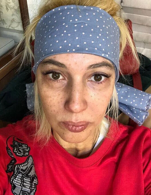 Лера Кудрявцева без макияжа