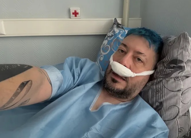 Артемий Лебедев показал лицо после пластики