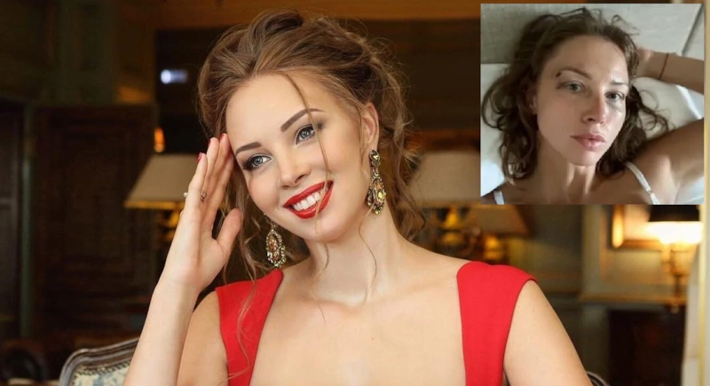 Полина Диброва рассказала о синяках на лице Полина Диброва рассказала о синяках на лице