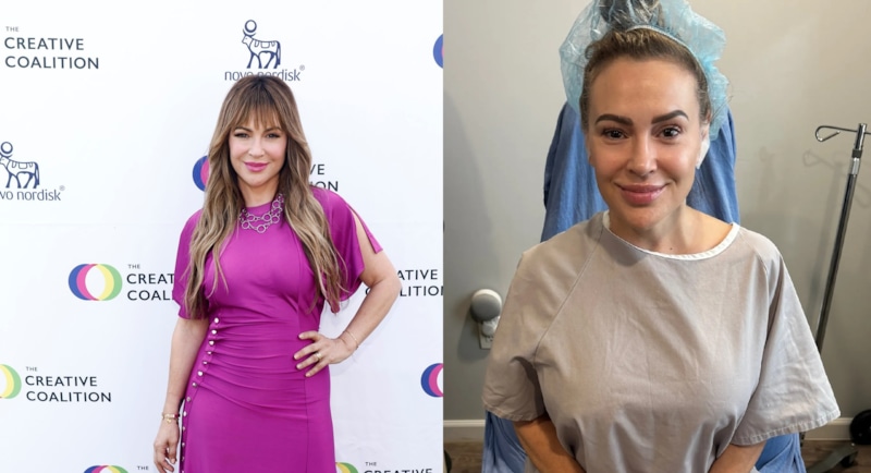 Алисса Милано удалила импланты