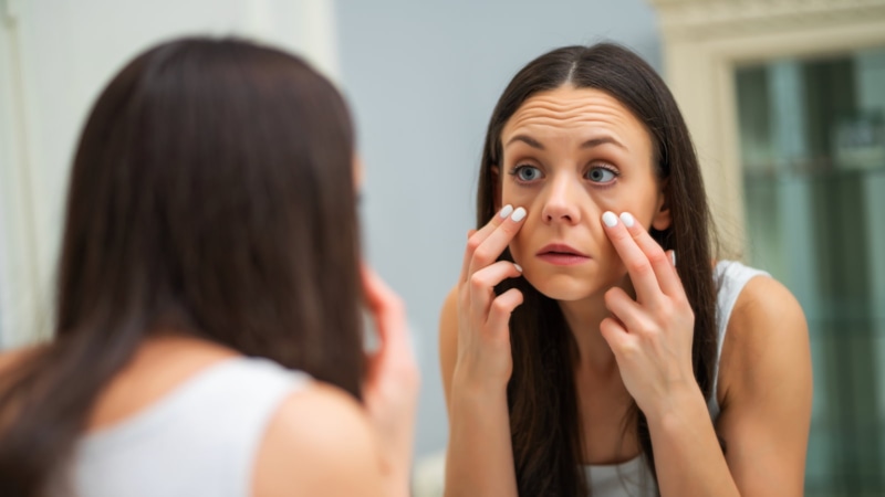 Синяки под глазами: как убрать