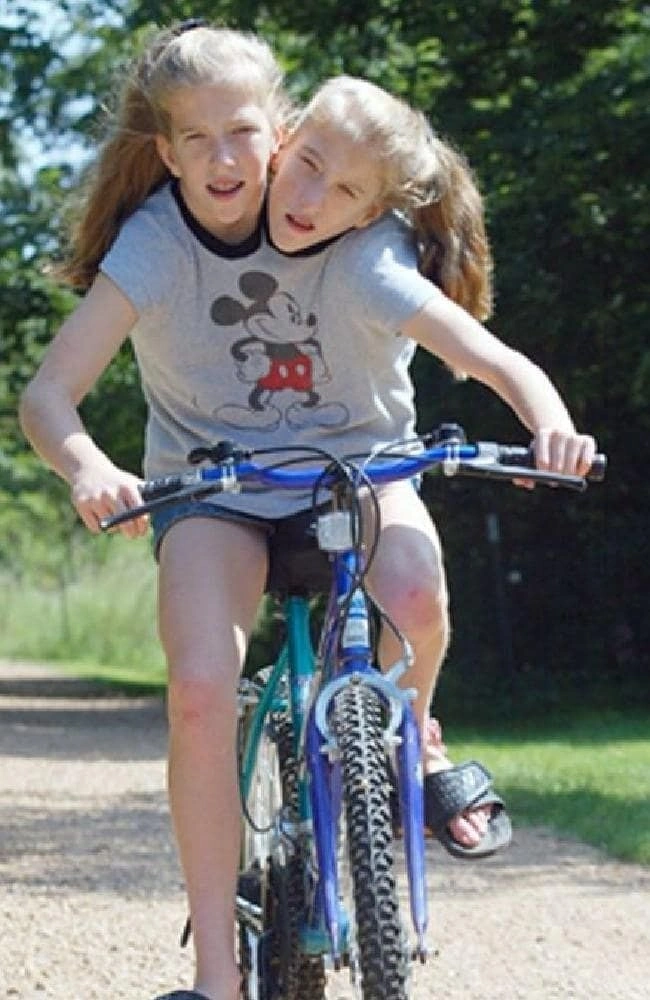 Сестры Хенсел в детстве