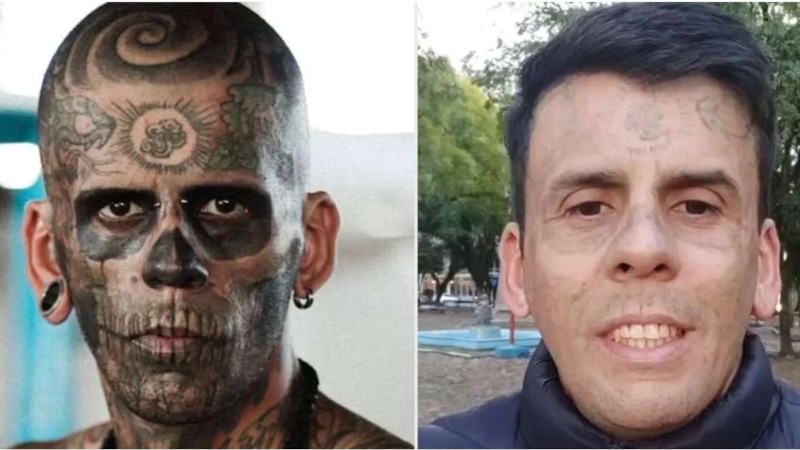 Лиандро де Соуза избавился от 170 татуировок Лиандро де Соуза избавился от 170 татуировок