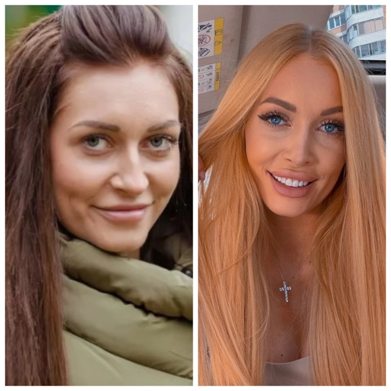 Кристина Дерябина до и после пластики