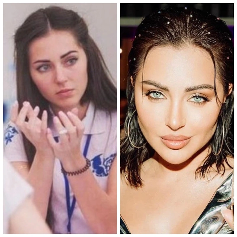 Виолетта Чиковани до и после пластики