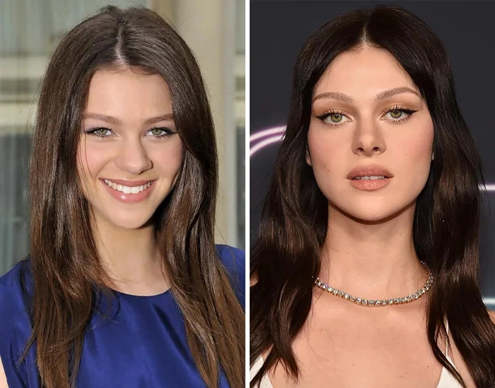 Никола Пельтц до и после пластики Никола Пельтц до и после пластики