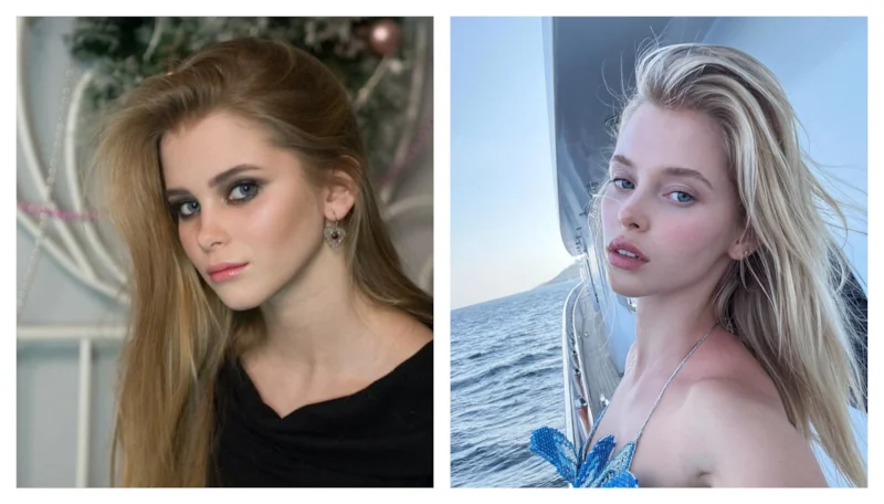 Алла Брулетова до и после пластики