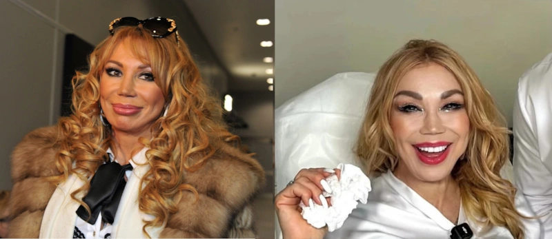 Хирург раскрыл секрет омоложения Маши Распутиной после свадьбы