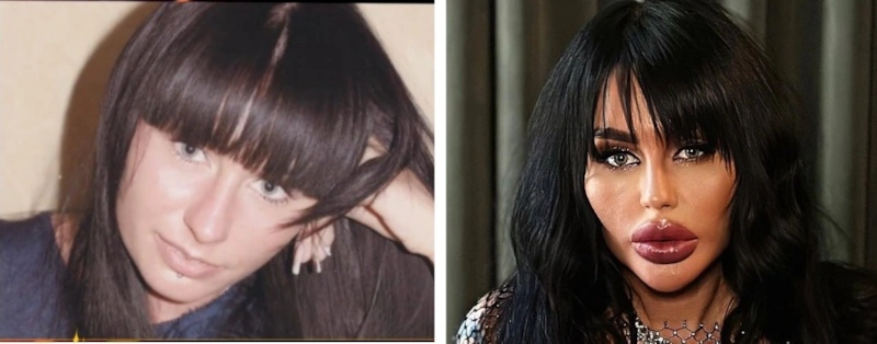 Алекса Девил до и после пластики