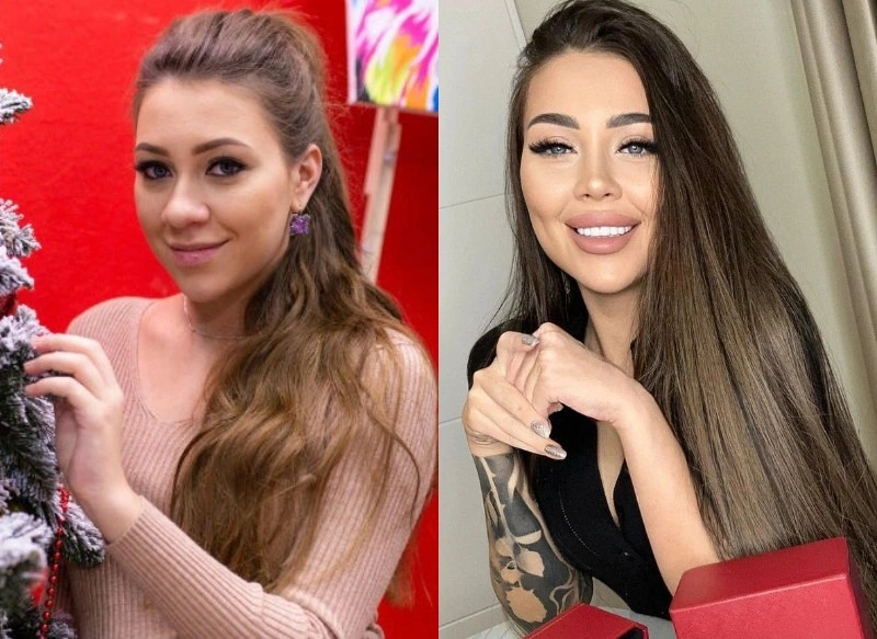 Алена Рапунцель до и после пластики Алена Рапунцель до и после пластики