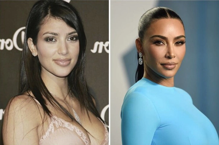 Ким Кардашьян до и после пластики