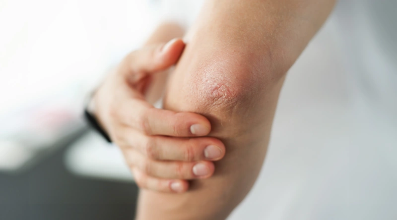 Сухая кожа зимой: домашний уход