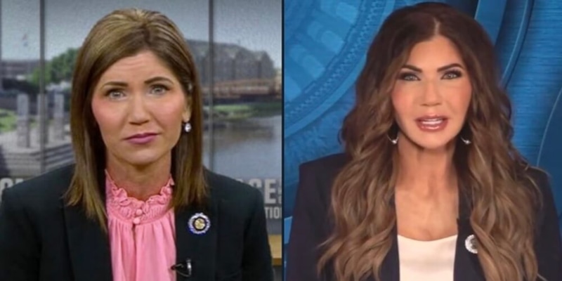 Кристи Ноэм до и после пластики