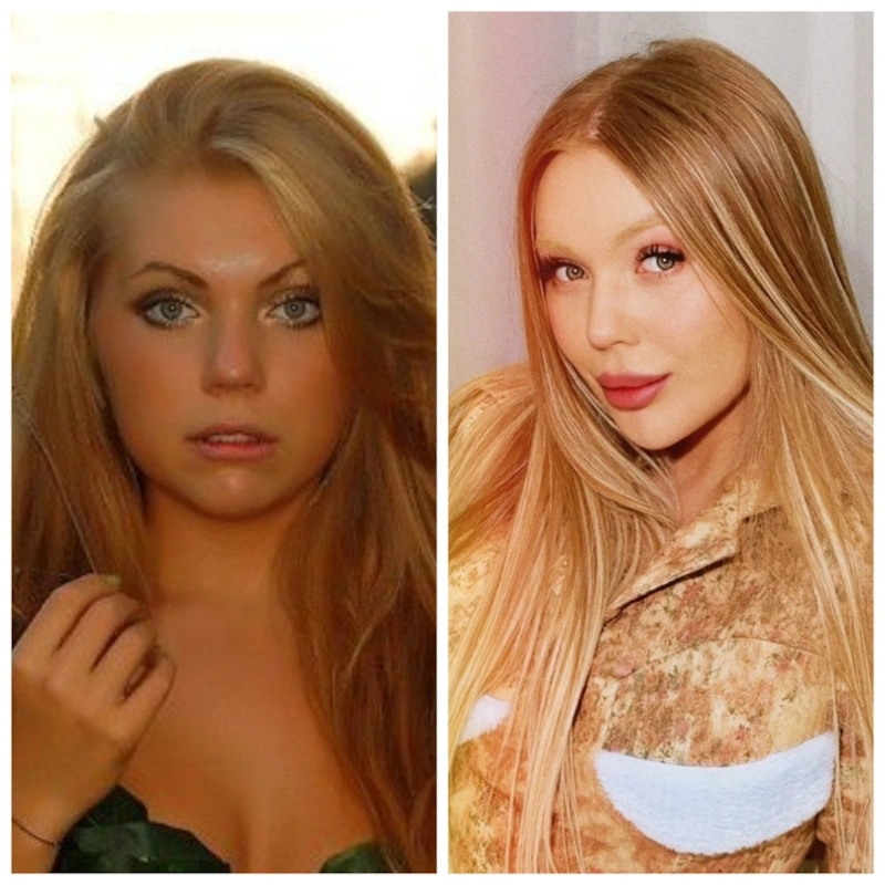 Карина Кросс до и после пластики