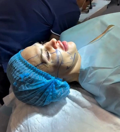 Ксения Задойнова сделала пластику