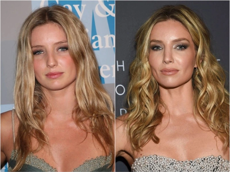 Аннабелль Уоллис до и после пластики