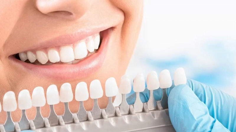 Улыбка без мифов: правда об отбеливании