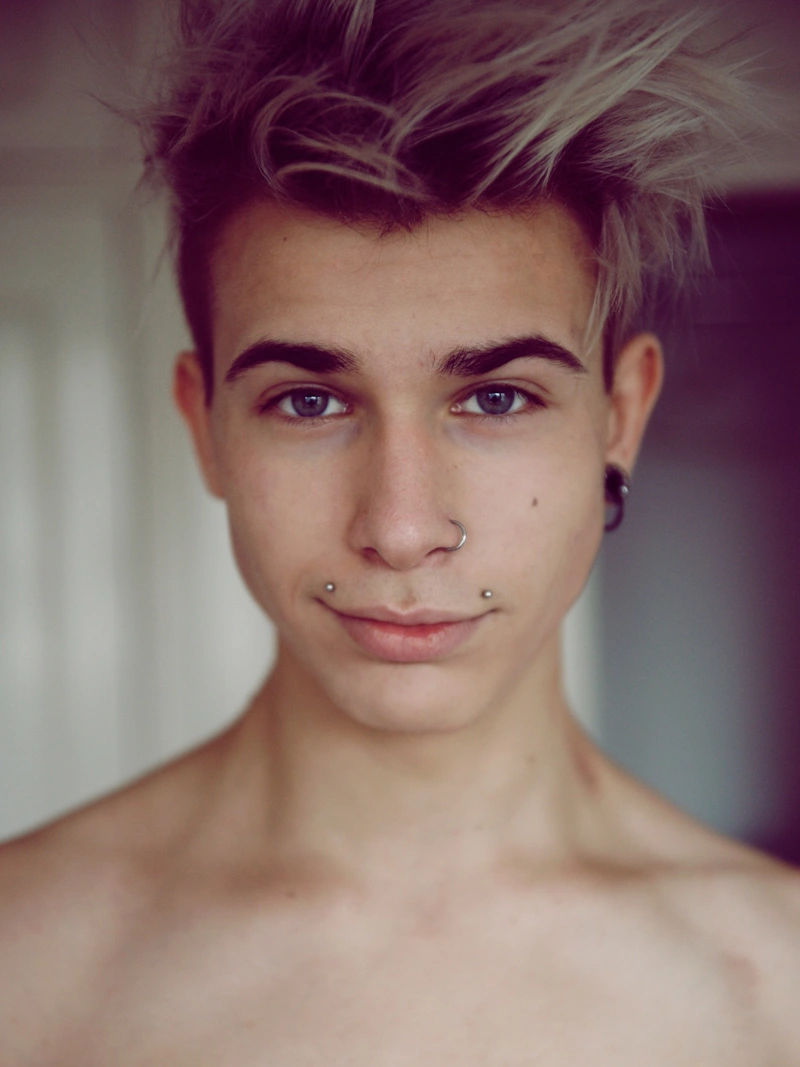 Алексис Стоун до пластики