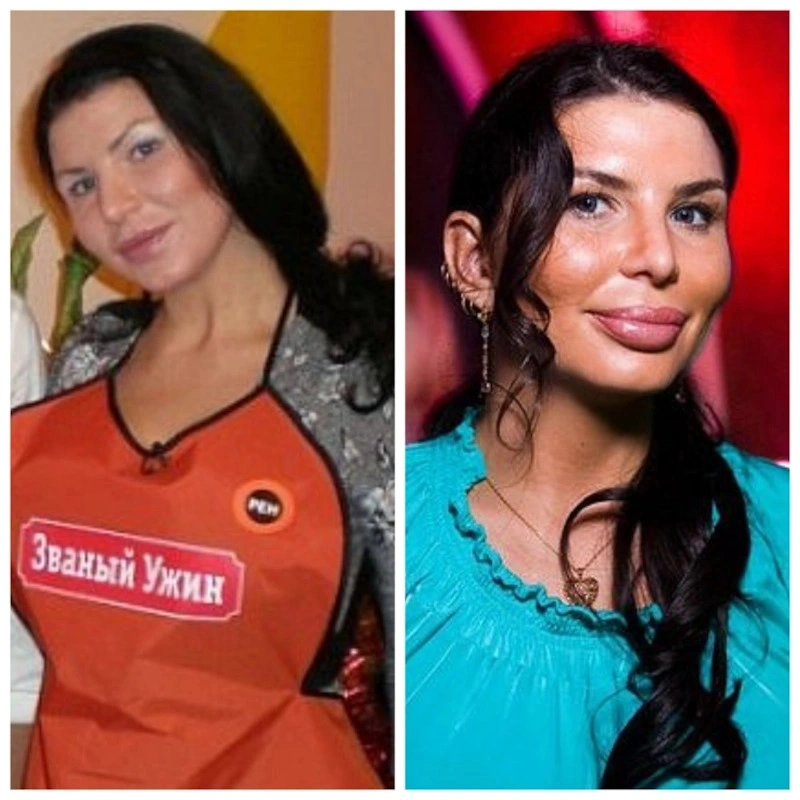 Ирен Феррари до и после пластики Ирен Феррари до и после пластики