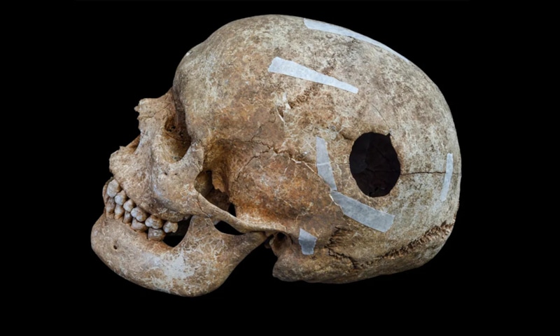 Следы прошлого: древняя медицина