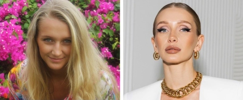 Алина Левда до и после пластики