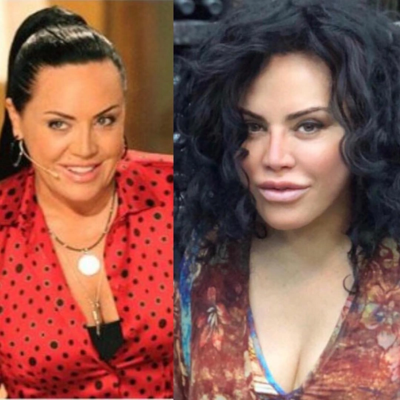 Оксана Байрак до и после пластики