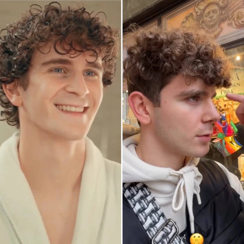 Артур Бабич до и после пластики