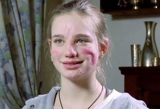Беатриче Вио в детстве