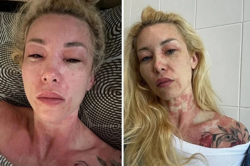 Екатерина Запашная очутилась на грани жизни и смерти в Крыму