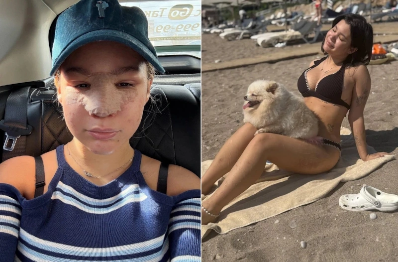 Дана Борисова рассказала, как 18-летняя дочь изуродовала себя пластикой