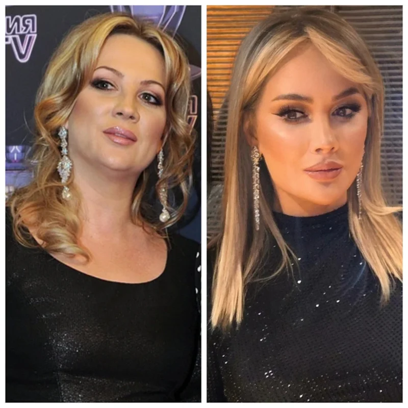 Инна Михайлова до и после пластики