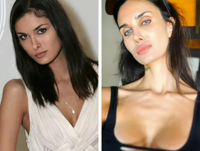 Алана Мамаева до и после пластики